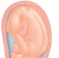 Как понять, что у беременной опустился живот перед родами?